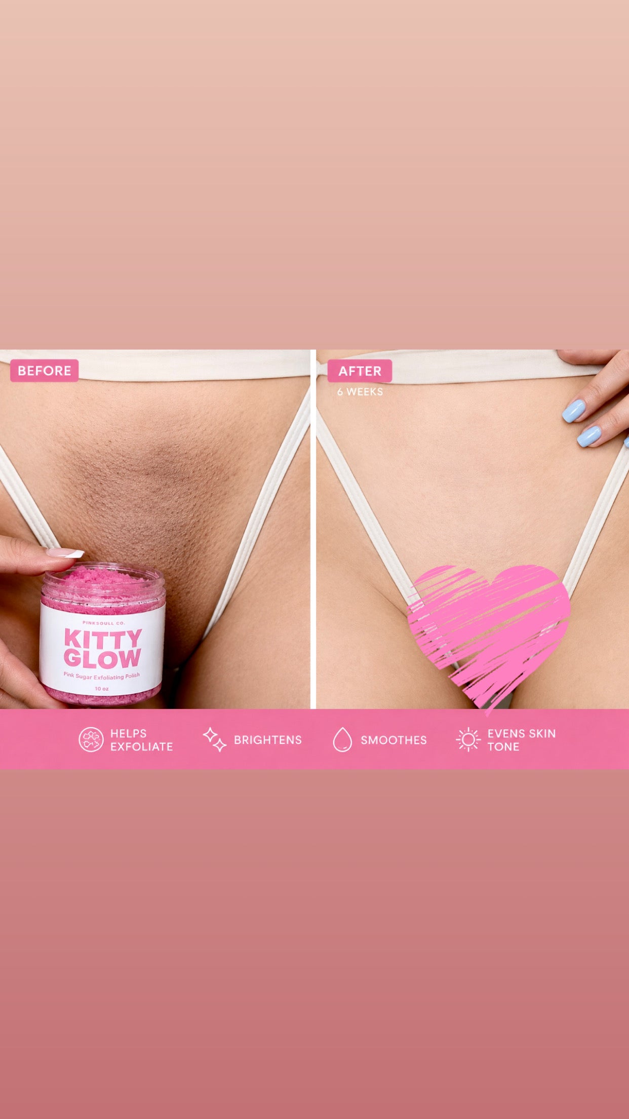 KITTY GLOW™ Pink Sugar Exfoliating Polish | 10 oz Sugar Scrub |